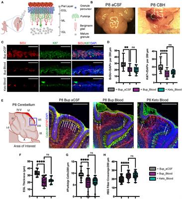 Neonatal subarachnoid hemorrhage disrupts multiple aspects of cerebellar development